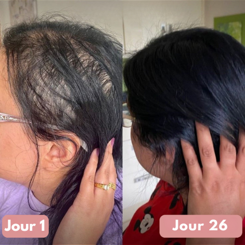 Capsules Cheveux Éclatants