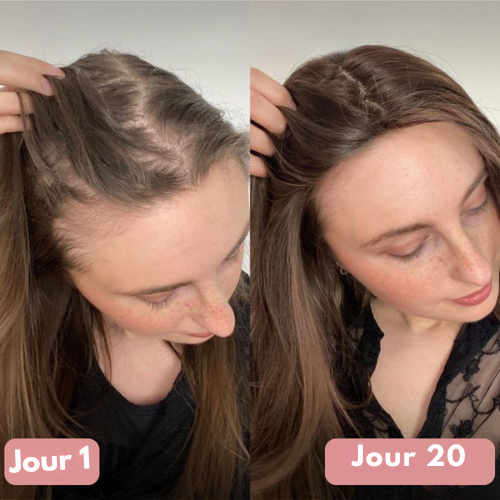 Capsules Cheveux Éclatants